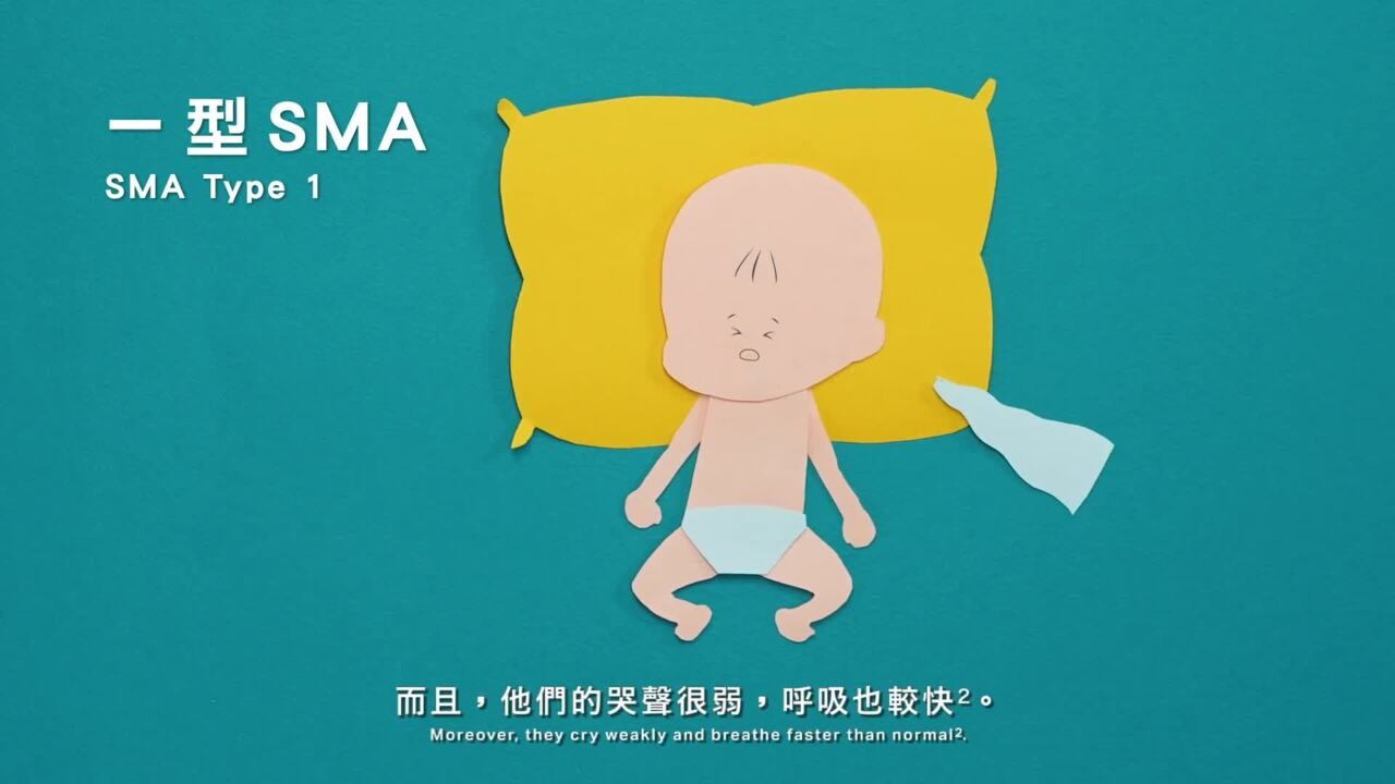 What is Spinal Muscular Atrophy (SMA)?